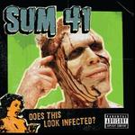 SUM 41