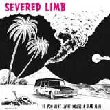 SEVERED LIMB