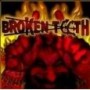 BROKEN TEETH