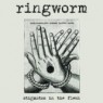 RINGWORM