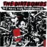 DIRTBOMBS